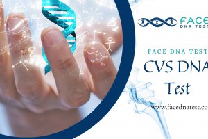 Detailed procedure of the CVS DNA test