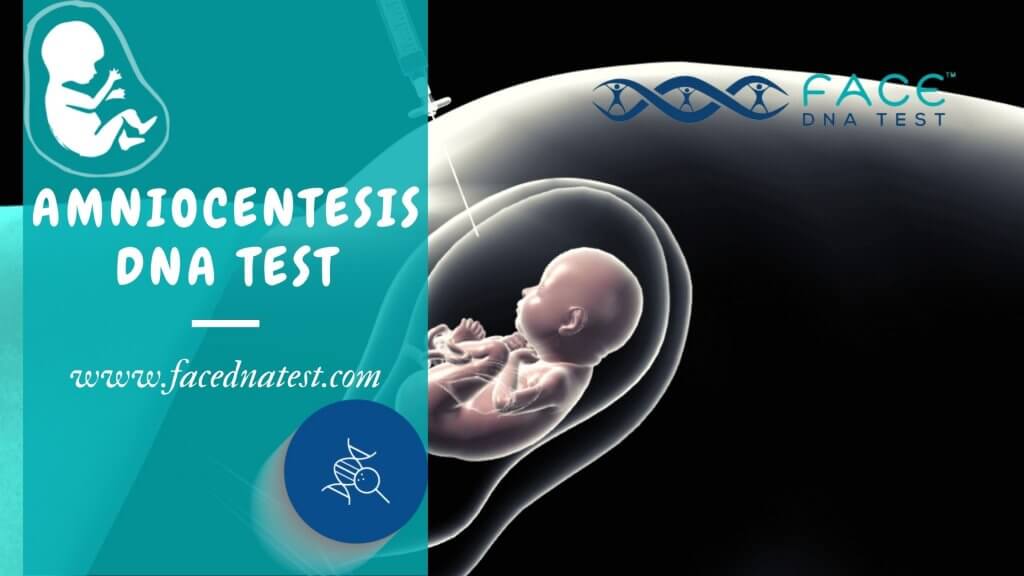 Amniocentesis DNA Test