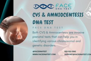 CVS & Amniocentesis DNA Tests