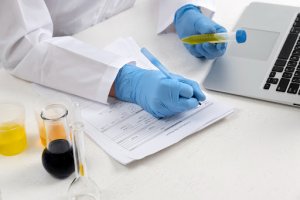 Drug Test vs Lab Test