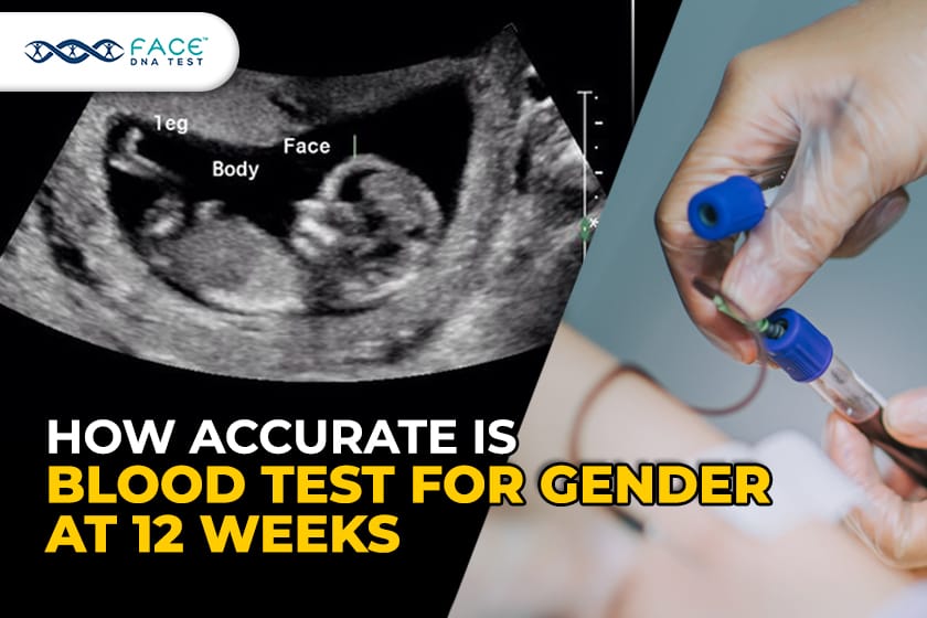 Non Invasive Prenatal Paternity Test