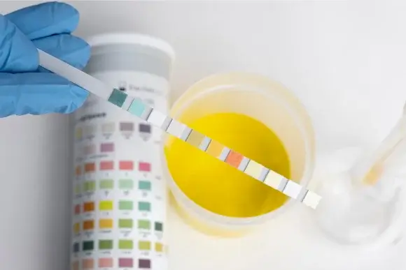 Understanding 10-panel drug screening Test